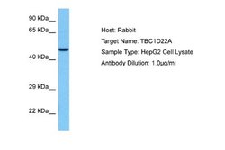 TBC1D22A Antibody, Novus Biologicals 100 &mu;L; Unconjugated:Antibodies,